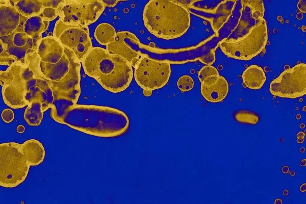 Soyut mavi sarı arka plan. Lekeler ve kabarcıklar. Alkol mürekkebi sanatı. Sembol.