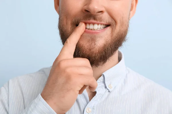 Junger Mann Mit Gesundem Zahnfleisch Auf Farbigem Hintergrund Nahaufnahme — Stockfoto