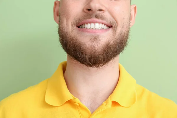 Joven Con Encías Sanas Sobre Fondo Color Primer Plano — Foto de Stock