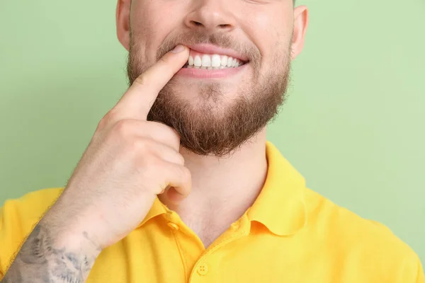 Junger Mann Mit Gesundem Zahnfleisch Auf Farbigem Hintergrund Nahaufnahme — Stockfoto