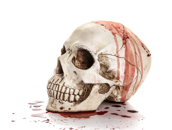 Bloodstained Human Skull White Background — Stock Photo, Image