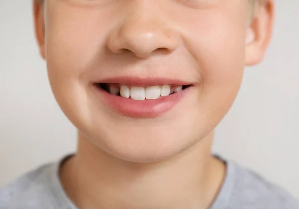 Petit Garçon Avec Sourire Sain Sur Fond Clair Gros Plan — Photo