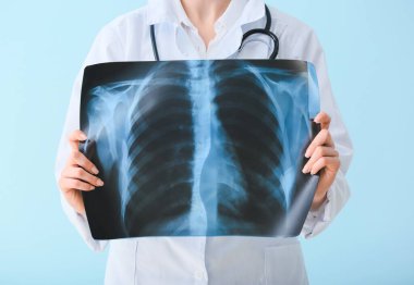 Kadın doktor, arka planda akciğerlerin röntgenini tutuyor.