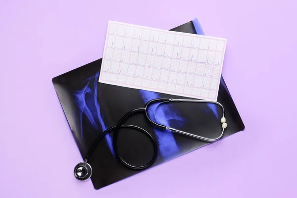 Ray Scan Lungs Cardiogram Stethoscope Color Background — Stock Photo, Image