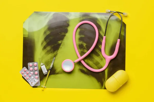 Röntgenbild Der Lungen Mit Stethoskop Und Medikamenten Auf Farbigem Hintergrund — Stockfoto