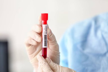 Laboratuvarda covid-19 örneği olan bir bilim adamı var.