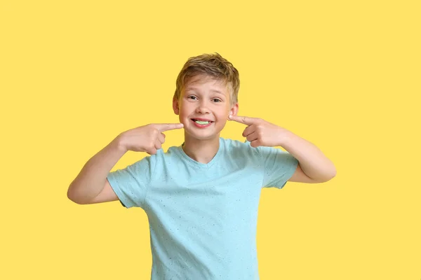 Küçük Çocuk Sarı Arka Plandaki Sakızı Işaret Ediyor — Stok fotoğraf