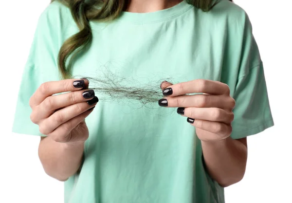 Saç Dökülmesi Sorunu Olan Genç Bir Kadın Beyaz Yakın Plan — Stok fotoğraf