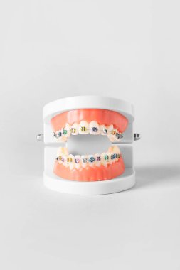 Beyaz arkaplanda diş telleri olan çene modeliName