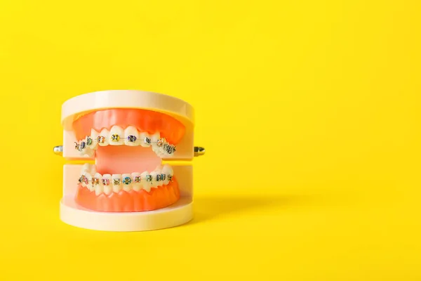 Sarı Arkaplanda Diş Telleri Olan Çene Modeliname — Stok fotoğraf