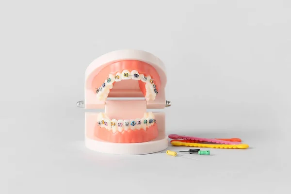 Kiefermodell Mit Zahnspangen Und Zahnwerkzeugen Auf Weißem Hintergrund — Stockfoto
