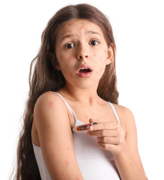 Kleines Windpocken Erkranktes Mädchen Isoliert Auf Weiß — Stockfoto