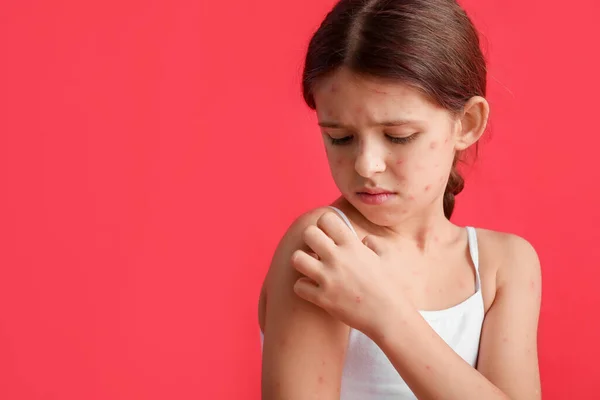 Little Girl Ill Chickenpox Red Background — Stock Photo, Image