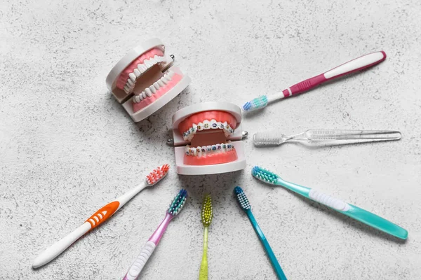 Model Jaws Braces Toothbrushes Light Background — Stock Photo, Image