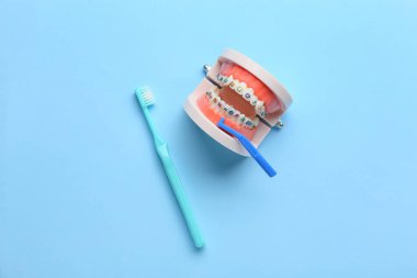 Mavi arkaplanda diş telleri ve diş fırçaları ile çene modeli