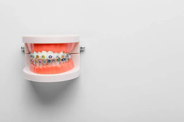 Modelo Mandíbula Con Tirantes Dentales Sobre Fondo Claro —  Fotos de Stock