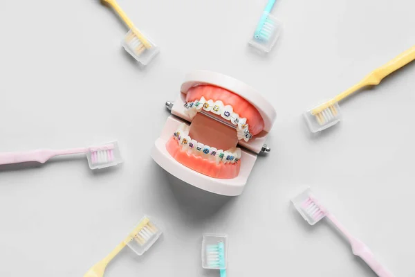 Modelo Mandíbula Con Frenos Dentales Cepillos Dientes Sobre Fondo Claro — Foto de Stock