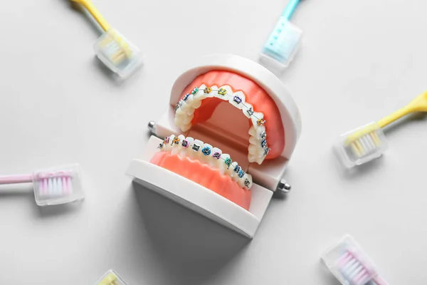 Modèle Mâchoire Avec Appareils Dentaires Brosses Dents Sur Fond Clair — Photo
