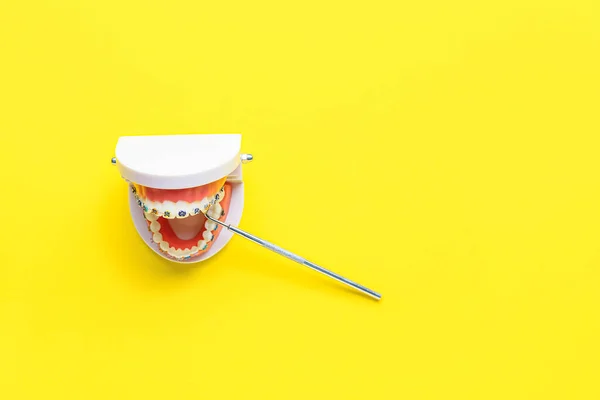 Μοντέλο Γνάθου Οδοντικά Στηρίγματα Και Οδοντιατρικό Εργαλείο Κίτρινο Φόντο — Φωτογραφία Αρχείου