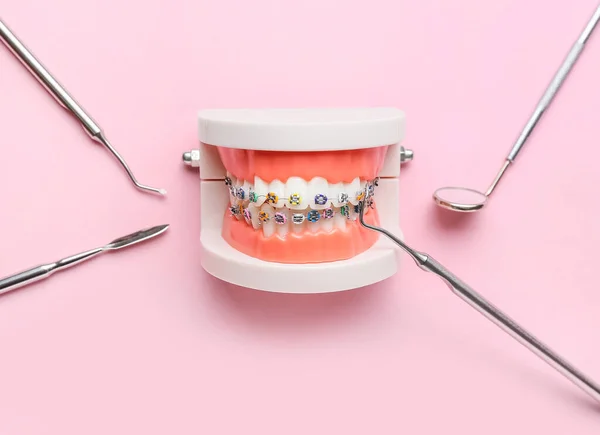 Modelo Mandíbula Com Aparelho Dentário Ferramentas Odontológicas Fundo Rosa — Fotografia de Stock