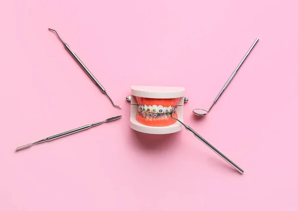 Model Jaw Dental Braces Dentist Tools Pink Background — Stock Photo, Image