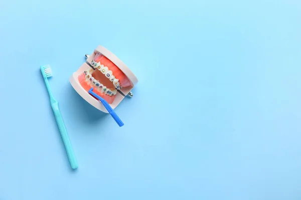 Modèle Mâchoire Avec Appareil Dentaire Brosses Dents Sur Fond Bleu — Photo