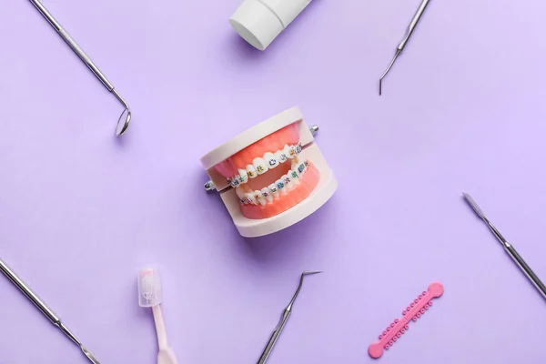 Modelo Mandíbula Con Aparatos Dentales Herramientas Dentista Sobre Fondo Lila — Foto de Stock