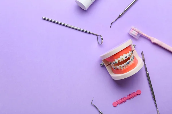 Modelo Mandíbula Con Aparatos Dentales Herramientas Dentista Sobre Fondo Lila — Foto de Stock