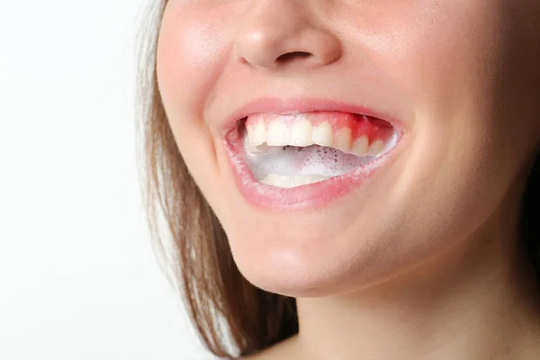 Frau Mit Zahnfleischentzündung Beim Zähneputzen Auf Weißem Hintergrund Nahaufnahme — Stockfoto