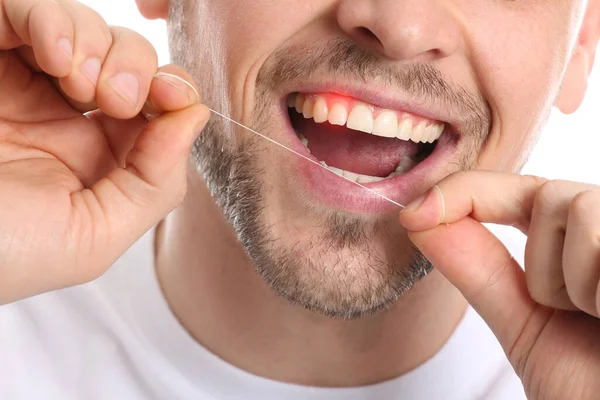 Man Gum Inflammation Flossing Teeth Closeup — Stock Photo, Image