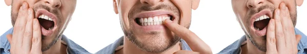 Набор Человек Страдает Зубной Боли Белом Фоне Крупным Планом — стоковое фото