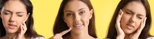 Sarı Arka Planda Diş Ağrısı Çeken Bir Grup Genç Kız — Stok fotoğraf