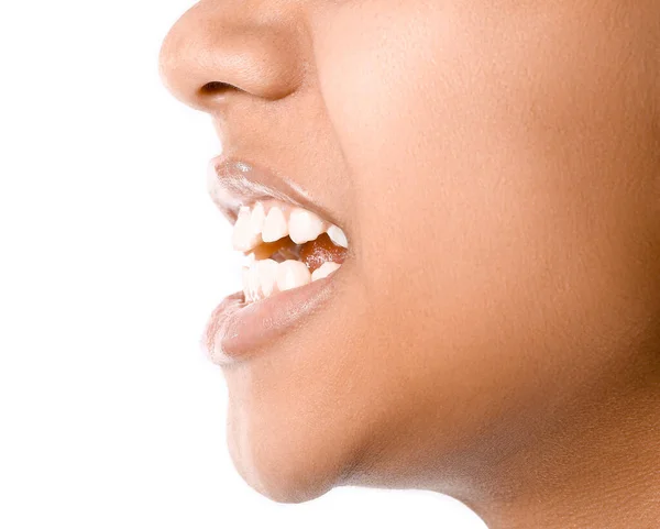 Teeth Teenage Girl White Background Closeup — Stock Photo, Image