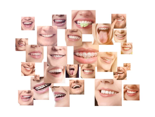 Колаж Багатьма Щасливими Усміхненими Людьми Білому Тлі — стокове фото