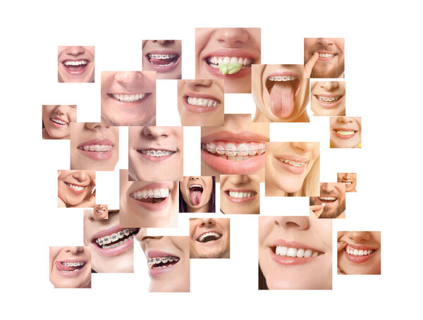 Collage with many happy smiling people on white background