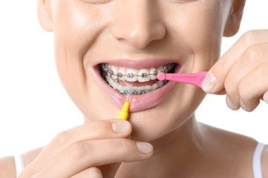 Beyaz arka planda diş telleriyle dişlerini fırçalayan kadın, yakın plan.