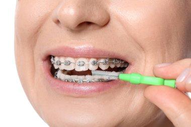 Beyaz arka planda diş telleriyle dişlerini fırçalayan kadın, yakın plan.