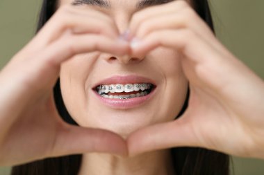Beautiful woman with dental braces making heart with her hands on color background clipart