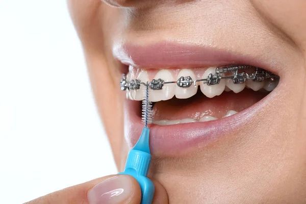 Kobieta Myjąca Zęby Aparatem Dentystycznym Białym Tle Zbliżenie — Zdjęcie stockowe