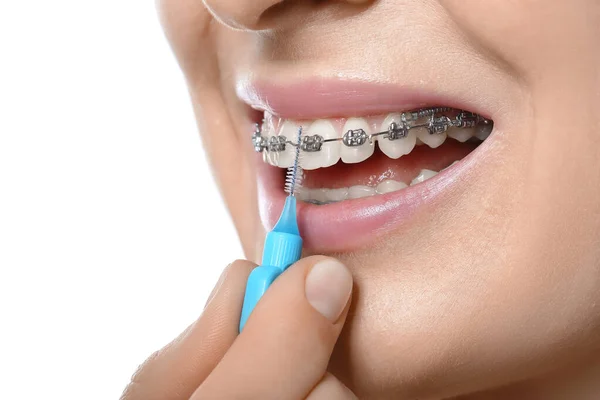 Frau Beim Zähneputzen Mit Zahnspange Auf Weißem Hintergrund Nahaufnahme — Stockfoto