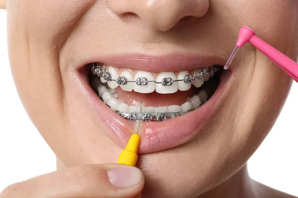 Donna Che Lava Denti Con Apparecchio Dentale Sfondo Bianco Primo — Foto Stock