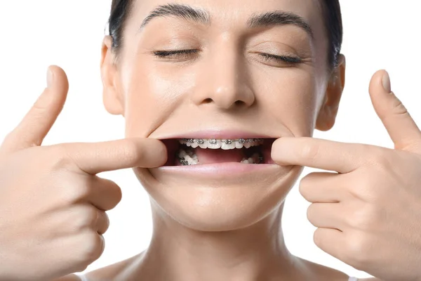 Beautiful Woman Dental Braces White Background Closeup — Stock Photo, Image