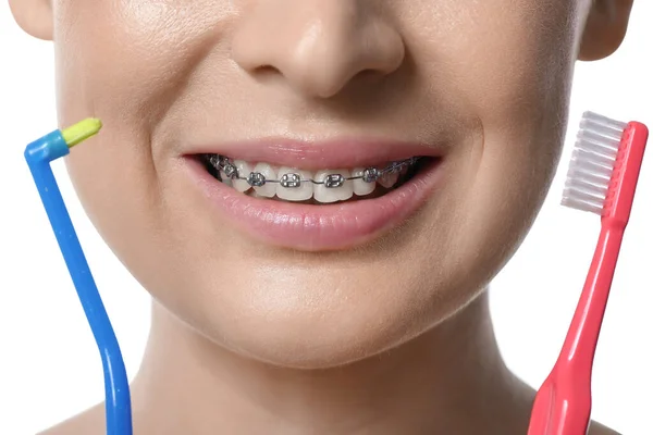 Piękna Kobieta Aparatem Dentystycznym Szczoteczką Zębów Białym Tle Zbliżenie — Zdjęcie stockowe