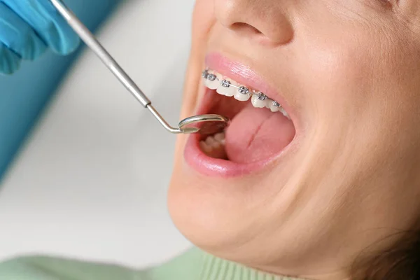 Kobieta Aparatem Dentystycznym Odwiedza Dentystę Klinice Zbliżenie — Zdjęcie stockowe