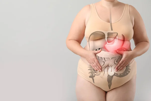 Mulher Com Excesso Peso Que Sofre Dor Estômago Fundo Claro — Fotografia de Stock