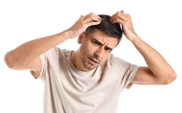 Worried Young Man Hair Loss Problem White Background — 스톡 사진
