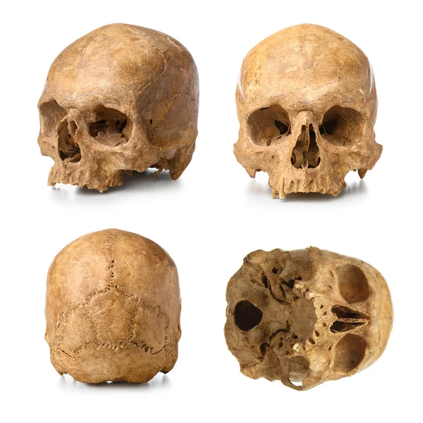 Set Old Human Skulls Isolated White — Stock Photo, Image