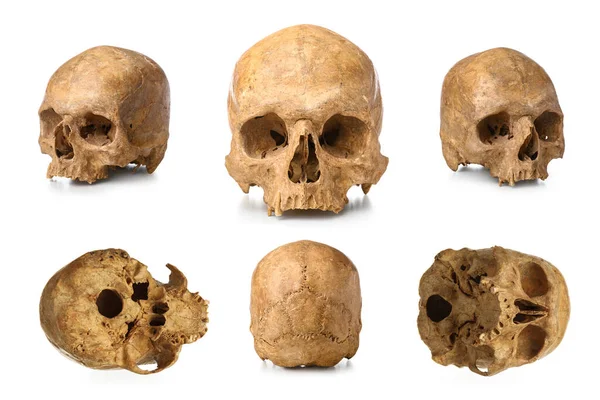 Set Old Human Skulls Isolated White — Stock Photo, Image