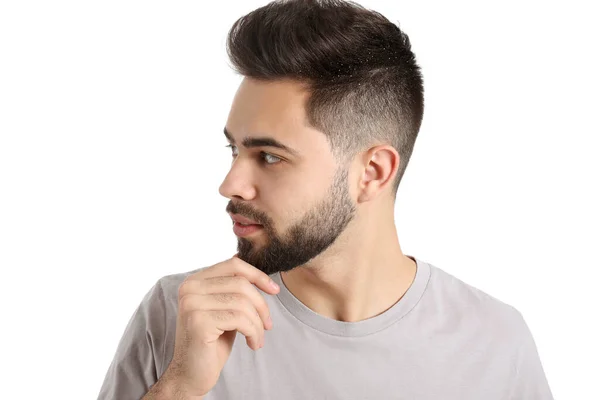 Young Man Problem Dandruff Isolated White — Stock Photo, Image