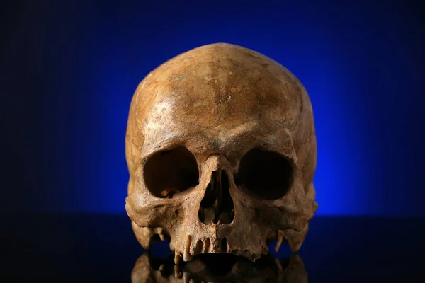 Cráneo Humano Antiguo Sobre Fondo Negro —  Fotos de Stock